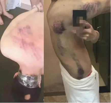 缅北的电信诈骗数据,缅北的电信诈骗人