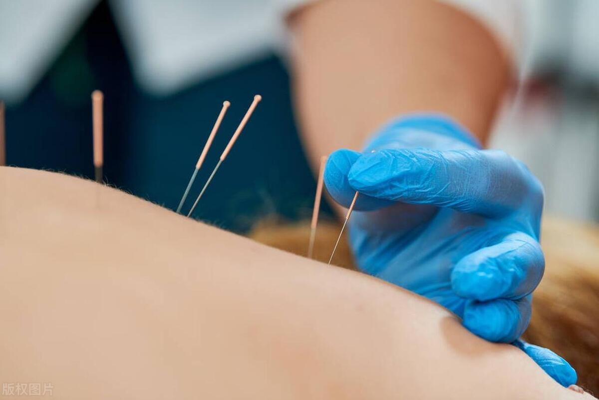 什么是寒湿症状,寒湿体质怎么调理才能根除湿气