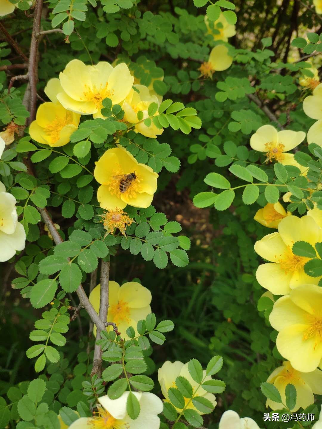 引起急性肾小球肾炎的常见病,急性肾小球肾炎与呼吸道感染