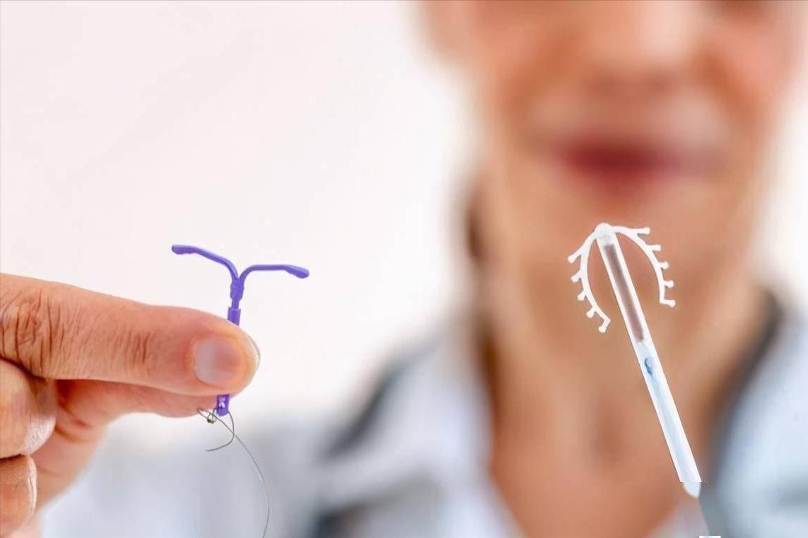 女人上环什么流程,女人上环流程