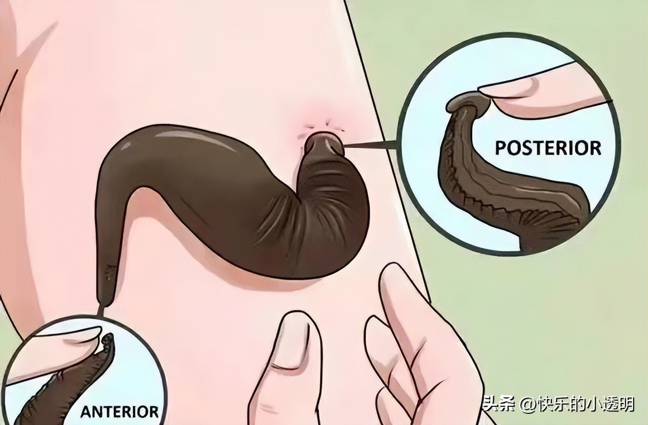 如果蚂蟥吃进肚子里能长期存活吗,蚂蟥食入体内能存活吗