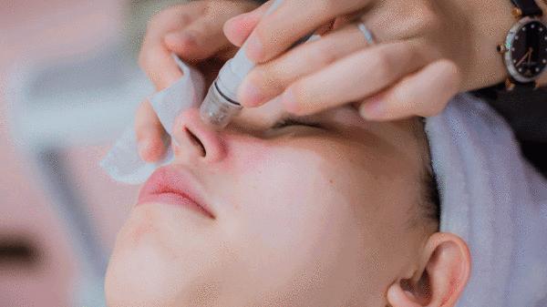 毛孔堵塞毛孔发黑怎样清理,毛孔长螨虫堵塞毛孔怎么办