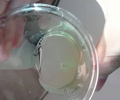 尿频尿急有白色分泌物怎么回事,尿频尿急尿道口滴白怎么回事