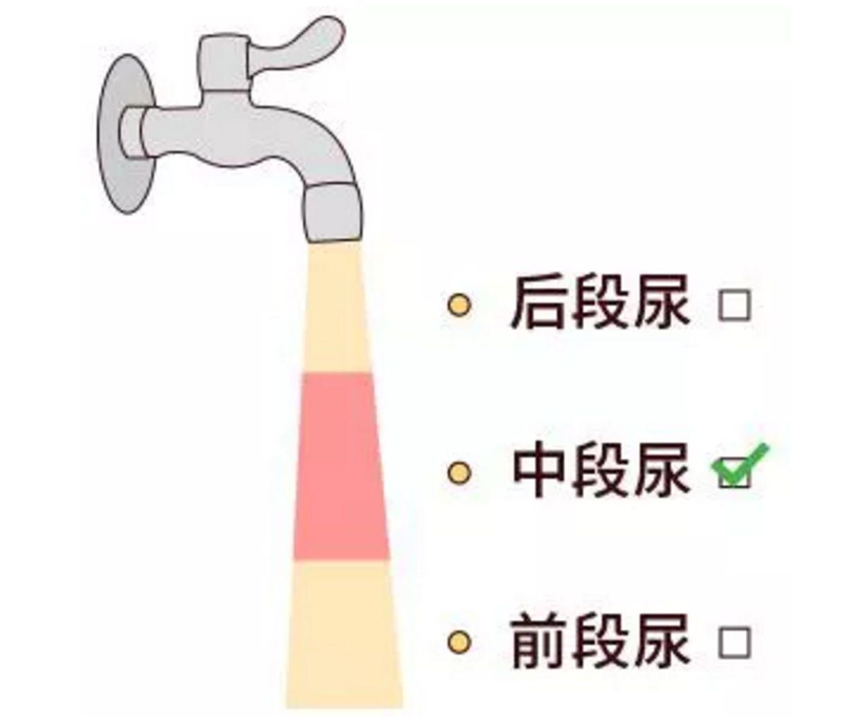 正确留取标本视频,常见标本采集与注意事项ppt