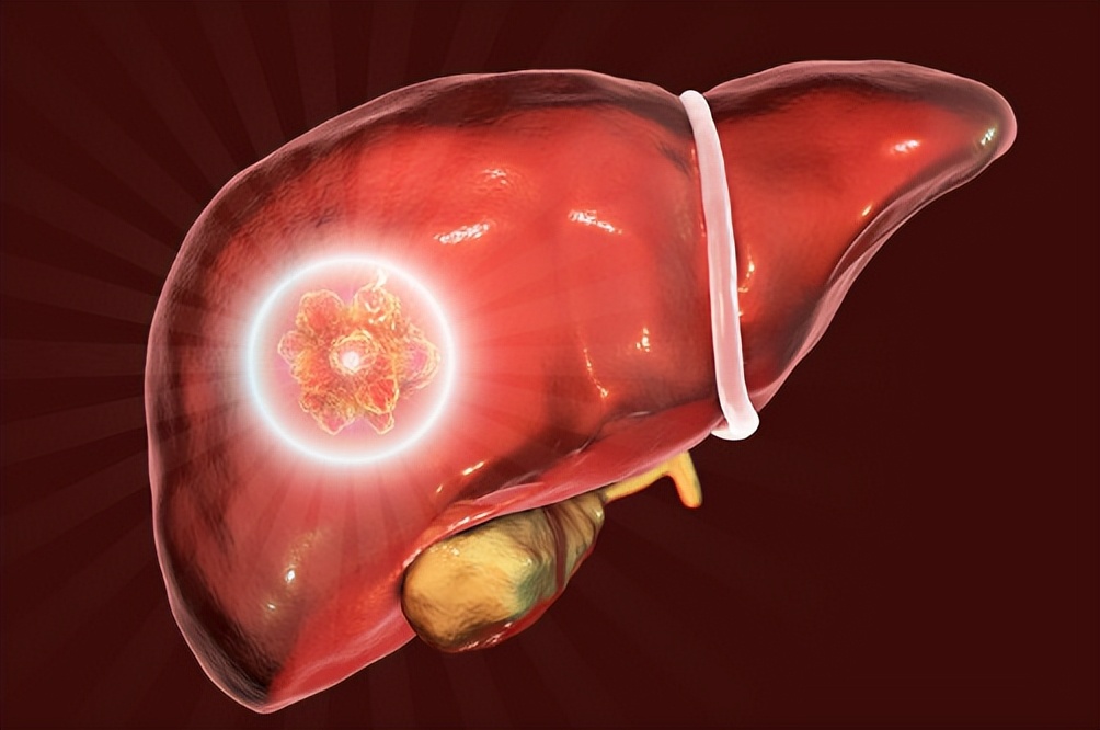 治疗越早康复越快越完全,什么样的患者更容易实现带瘤生存