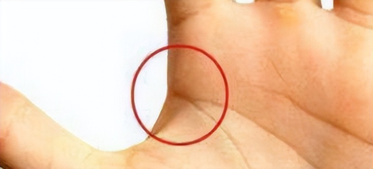 胳膊青筋手背青筋多是怎么回事,人体青筋明显是什么问题