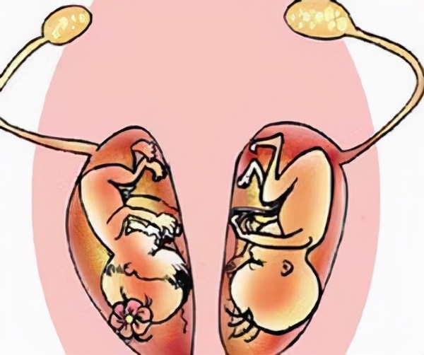 头胎刚满月又生二胎,头胎满月孕妇又要生产