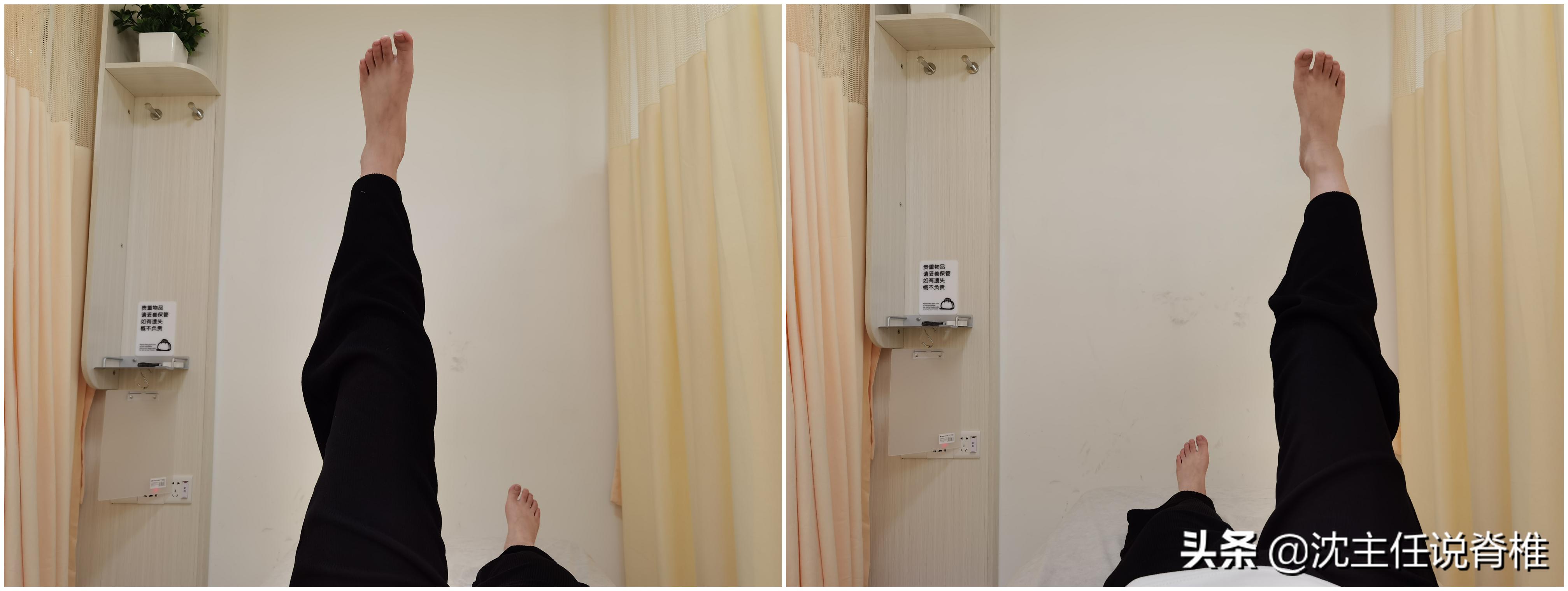 腰骶痛是不是腰突,腰骶疼是腰间盘突出吗