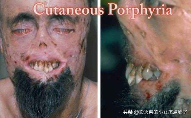 电影中的吸血鬼真的存在吗,吸血鬼起源的电影