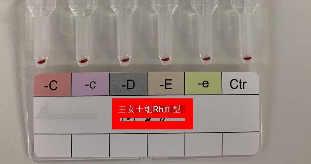 江苏发现2例罕见“黄金血型”,江苏现2例罕见黄金血型