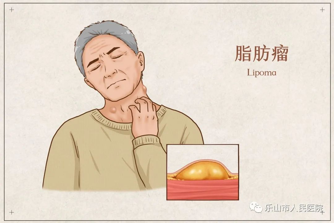 冬天适合做哪些医美项目,秋冬季适合做的医美项目