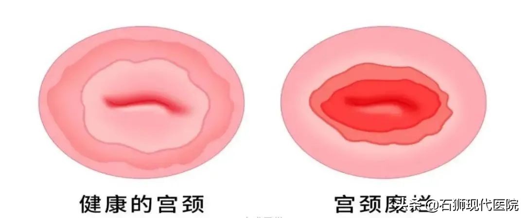 48岁的女人妇科体检应该做哪几项,妇科检查怎么查