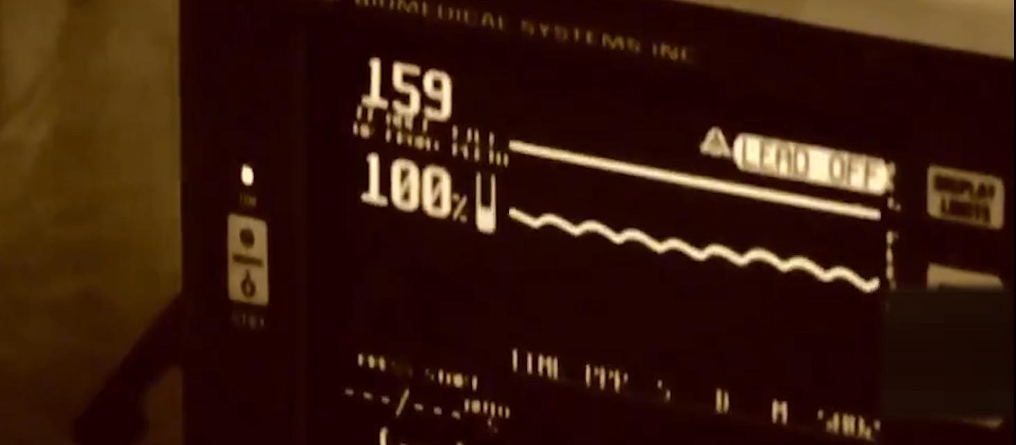 2016年，长春20岁大学生做包皮手术导致死亡，事故原因究竟为何？