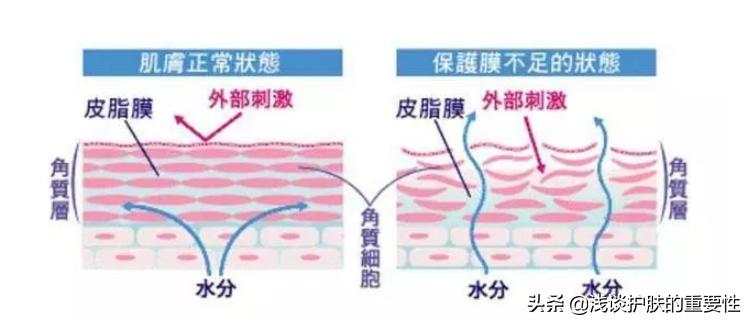 用完洗面奶后脸上干燥起皮怎么办,用完洗面奶脸部紧绷起皮怎么回事