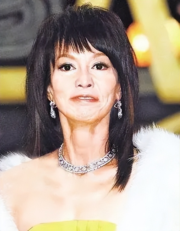 明星下颚骨整容后遗症,脸像鞋拔子怎么改善