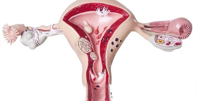 女性使用的避孕措施,安全套避孕失败补救措施