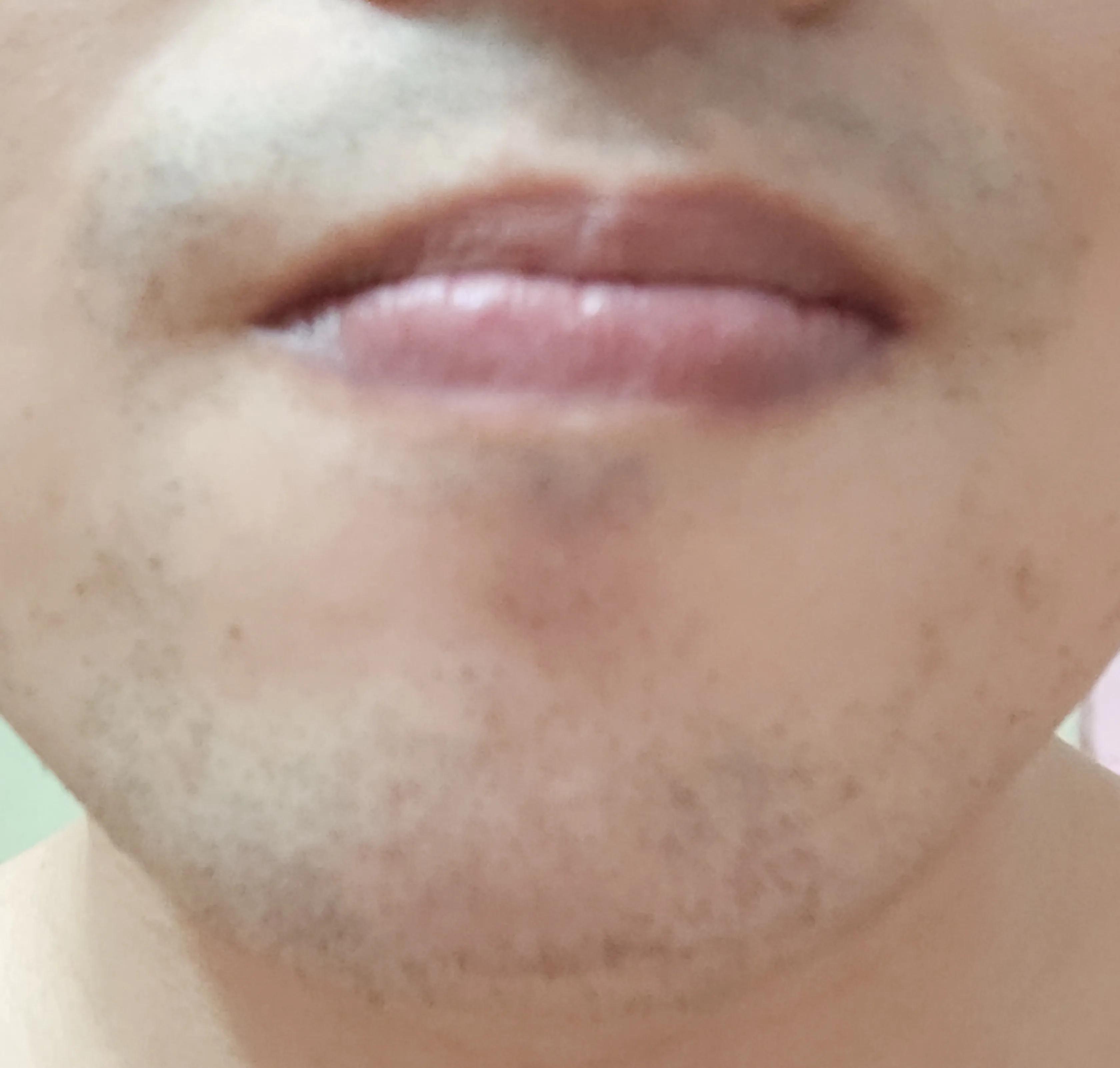 亲测脱毛有效方法,能脱男生胡子的脱毛仪实测