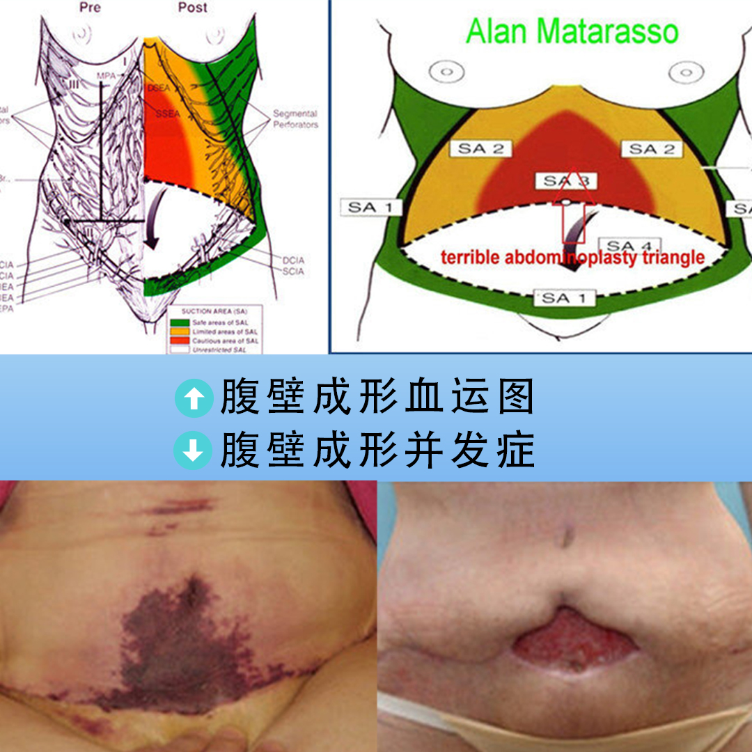 产后肚皮松松垮垮怎么练,产后肚皮松松垮垮怎么办啊