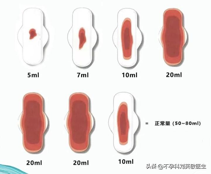 月经推迟痛经,痛经血块推迟出来