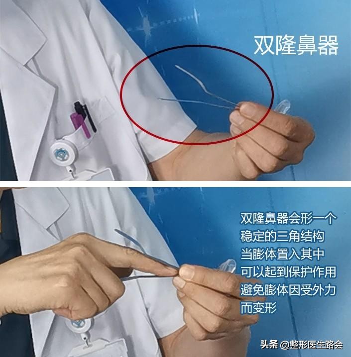 隆鼻手术全过程女生,隆鼻手术到底是怎么进行的