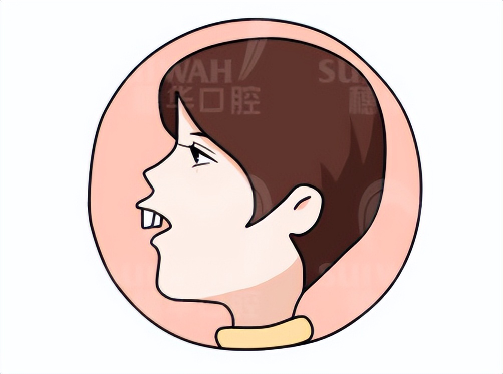 北大口腔医院儿童牙齿不齐矫正,儿童牙齿矫正北京大学口腔医院