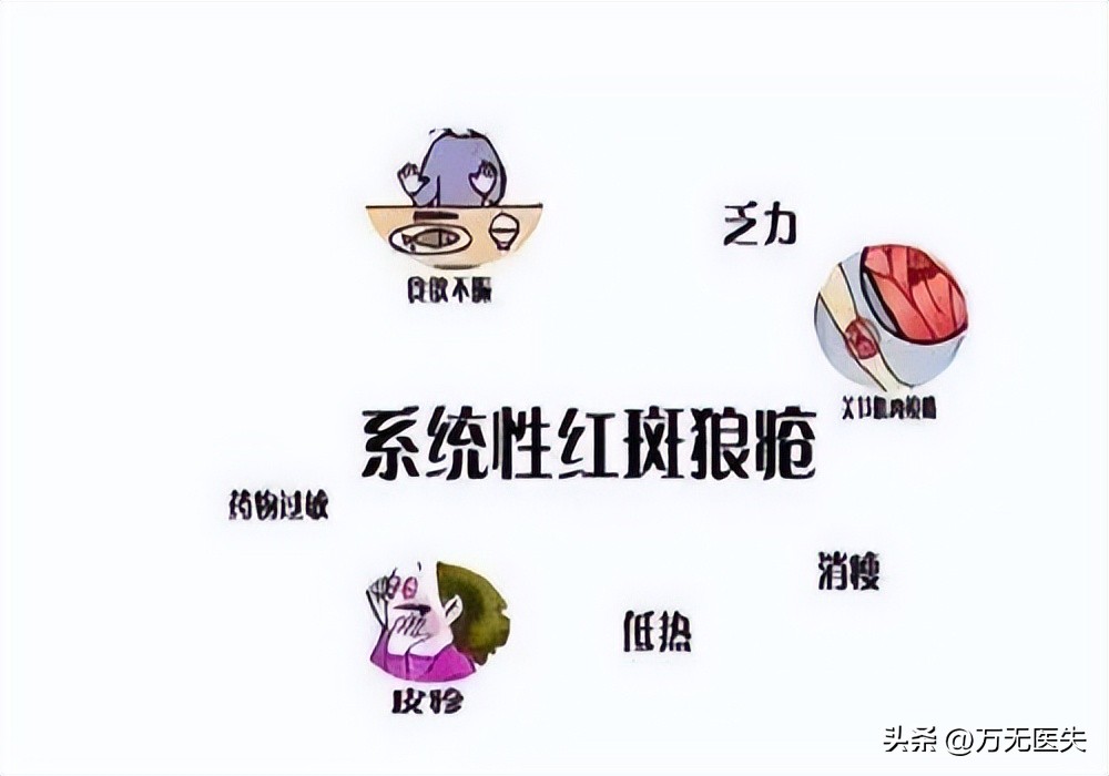 治狼疮的抗疟药,系统性红斑狼疮抗疟药