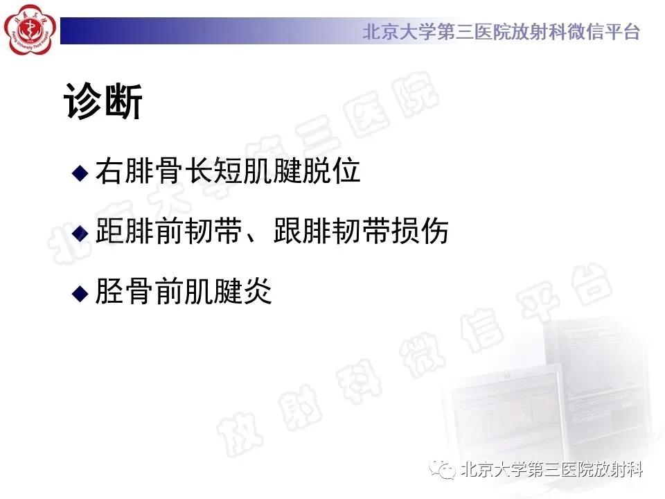 好文分享续集,腓骨肌腱脱位手术价格