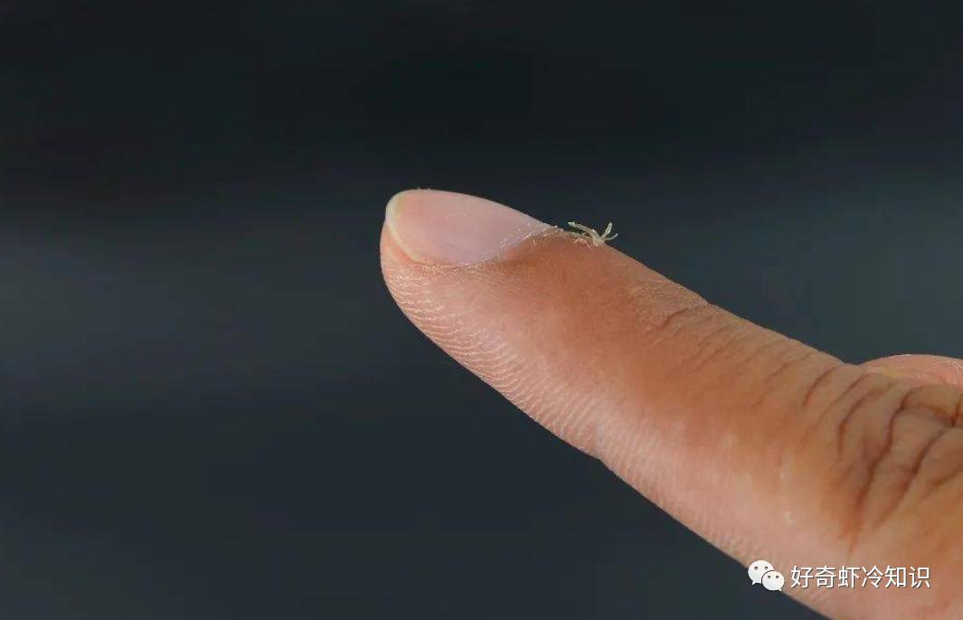 长了倒刺怎么弄才不会疼,长了倒刺到底要不要拔