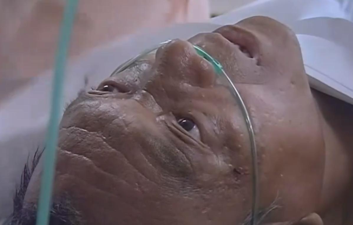 53岁父亲遭受车祸九死一生,父亲被卡车拦腰碾压救活了吗