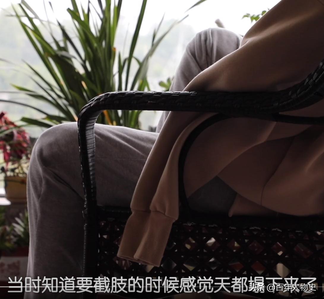 19年,四川20岁女孩遭大火毁容48%烧伤,双臂截肢如今怎么样了?