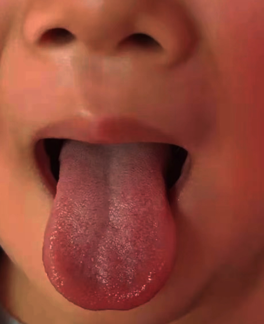 中医治疗儿童身高生长缓慢,8岁7个月长到140是不是早熟