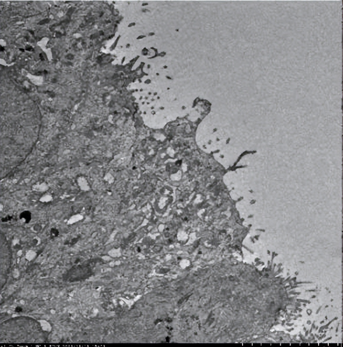 婴儿间断性咳嗽是怎么回事,儿童咳嗽肺部有微小结节有事吗