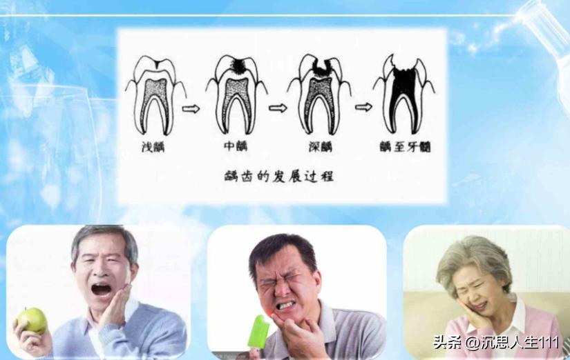 龋齿的形成原因和过程动画,龋齿发生机制的图片