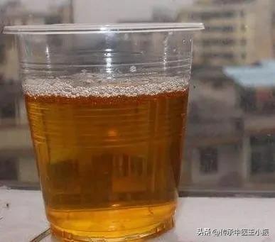 怕冷怕热是阴虚还是阳虚吃什么药,阴虚怕热阳虚怕冷没那么简单