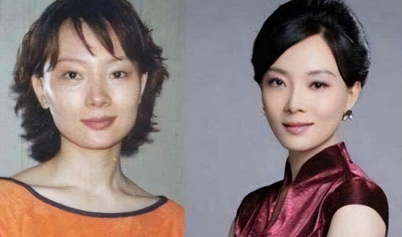 最近脸僵硬的女星,脸部变僵硬的女明星