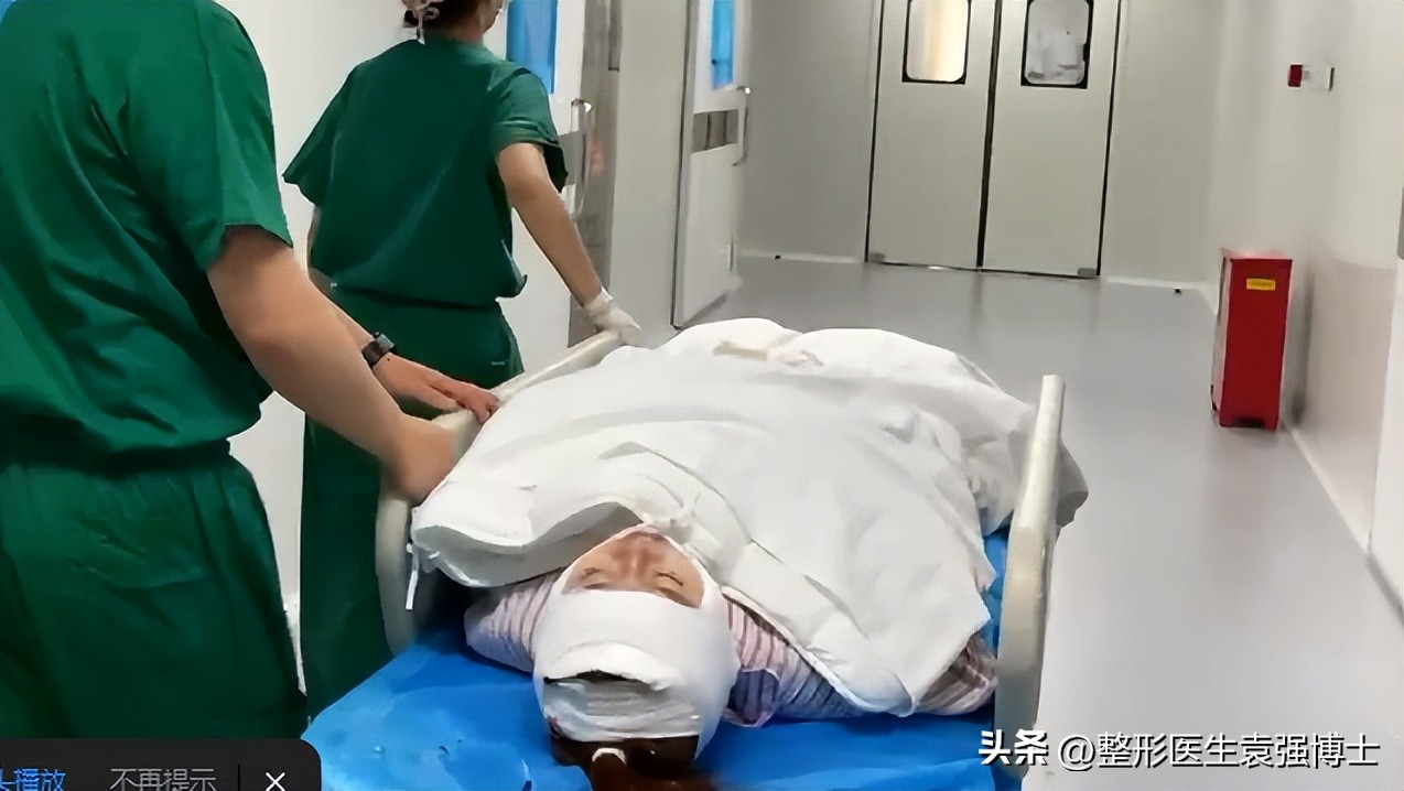 大拉皮术后一个脸大一个脸小,大拉皮后为什么一面脸大一面脸小