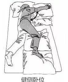 偏瘫早期康复之良肢位摆放,脑梗患者晚上睡觉怎样摆放姿势