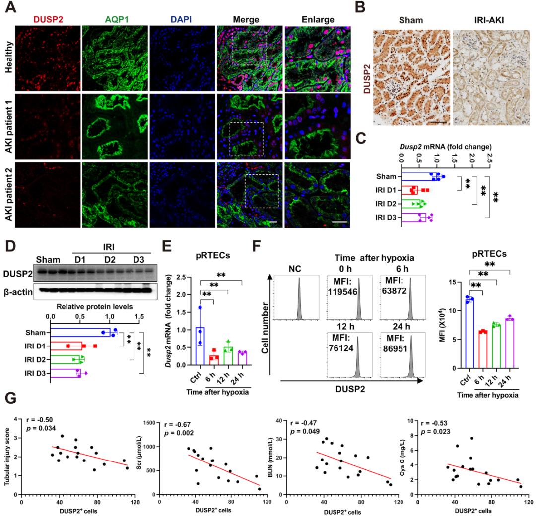 Theranostics|急性肾损伤治疗策略
