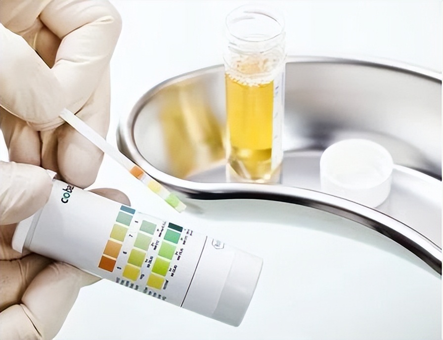 世界肾脏日正确识别肾病信号,世界肾脏日带你读懂尿常规报告