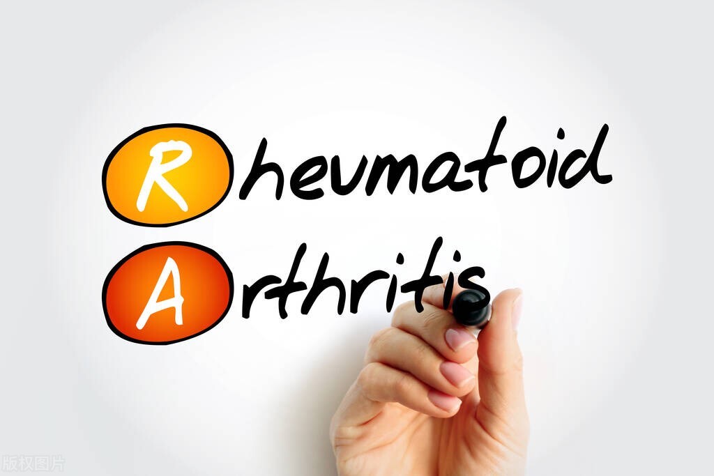 抗ccp阳性一定是类风湿关节炎吗,ccp升高类风湿因子升高
