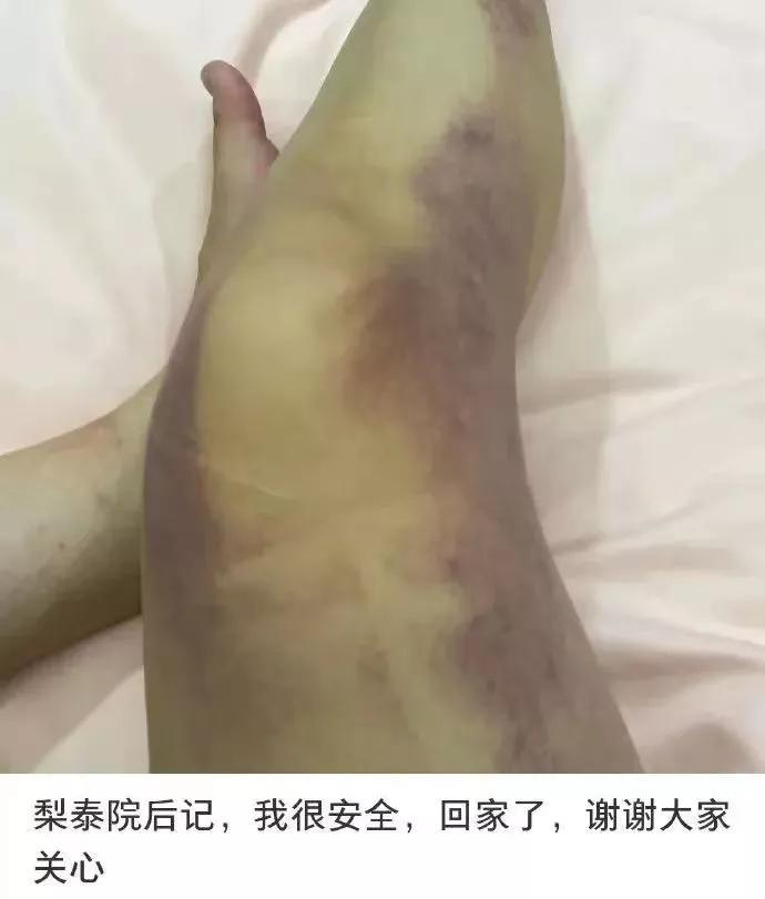 154人遇难！韩国*踏事踩**故，被挤到窒息、吐血，悲剧诱因是什么？