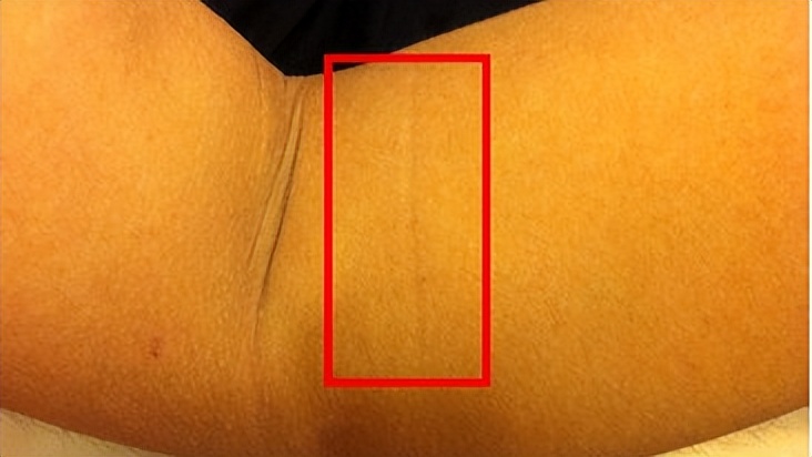 男性胸前两个点叫什么,男性胸前两个点