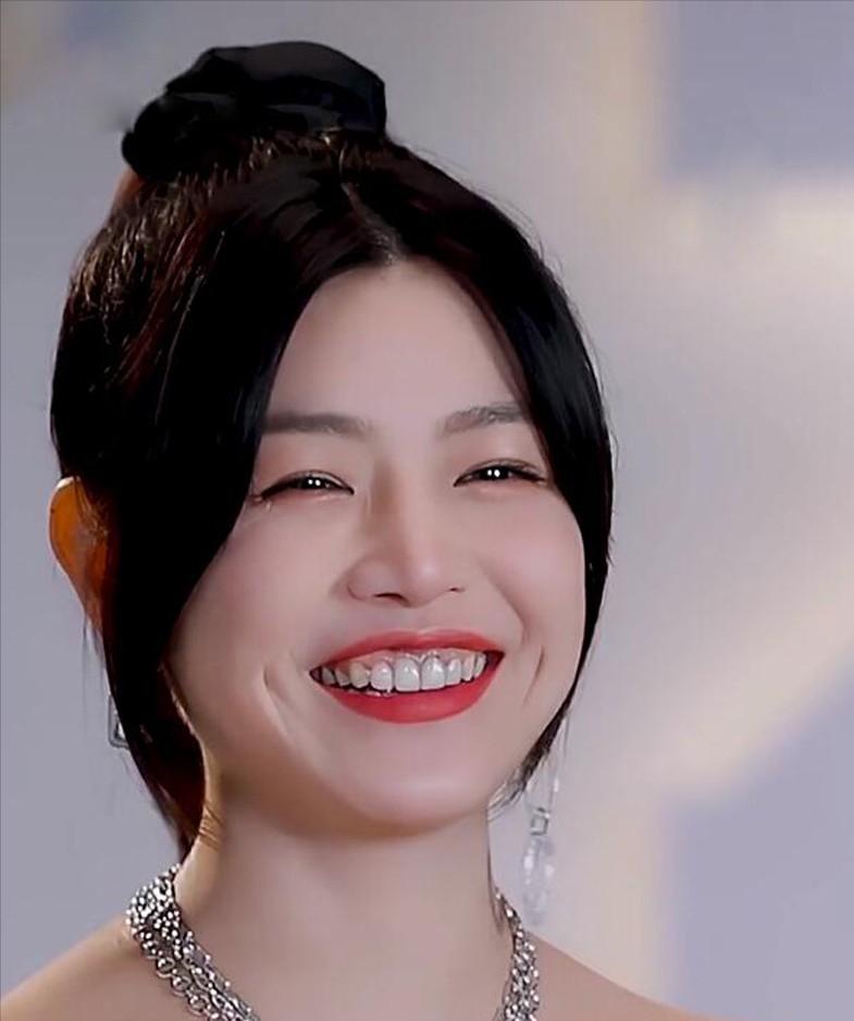 烤瓷牙的明星,烤瓷牙的明星都有谁