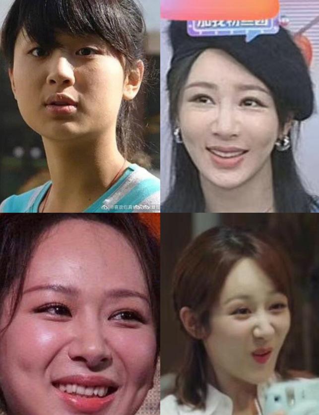 整容失败的女星蛇精脸,女星整容失败脸歪嘴斜