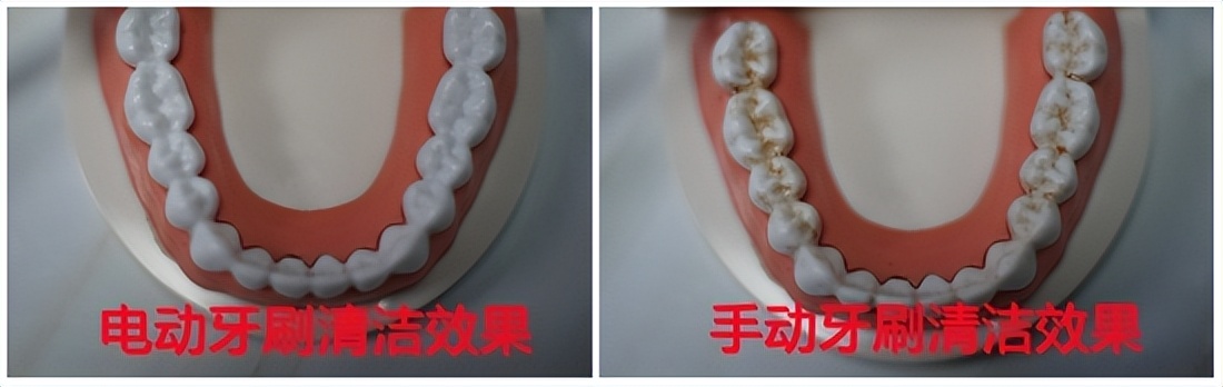 电动儿童牙刷6-12岁攻略,电动牙刷儿童6-12岁防蛀牙