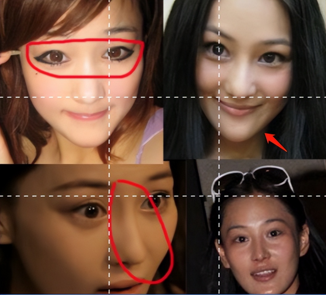 整容失败的女星蛇精脸,女星整容失败脸歪嘴斜