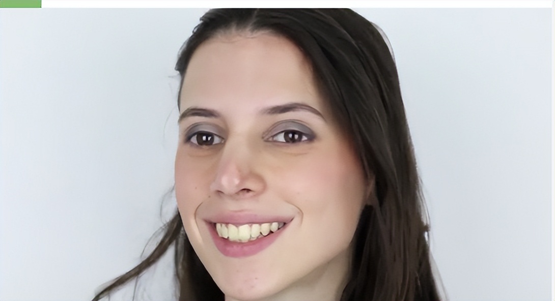 如何锻炼面部肌肉显得丰满,如何锻炼面部肌肉