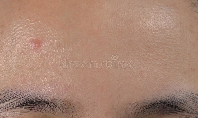 连续三天不洗脸皮肤会变好吗,三天不洗脸会怎么样