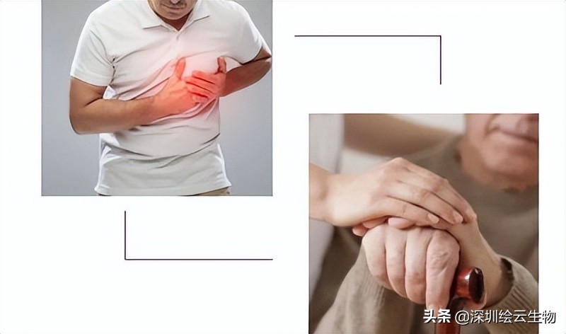 平常体检应该做哪些项目预防疾病,体检一般检查哪些项目入疾病筛查