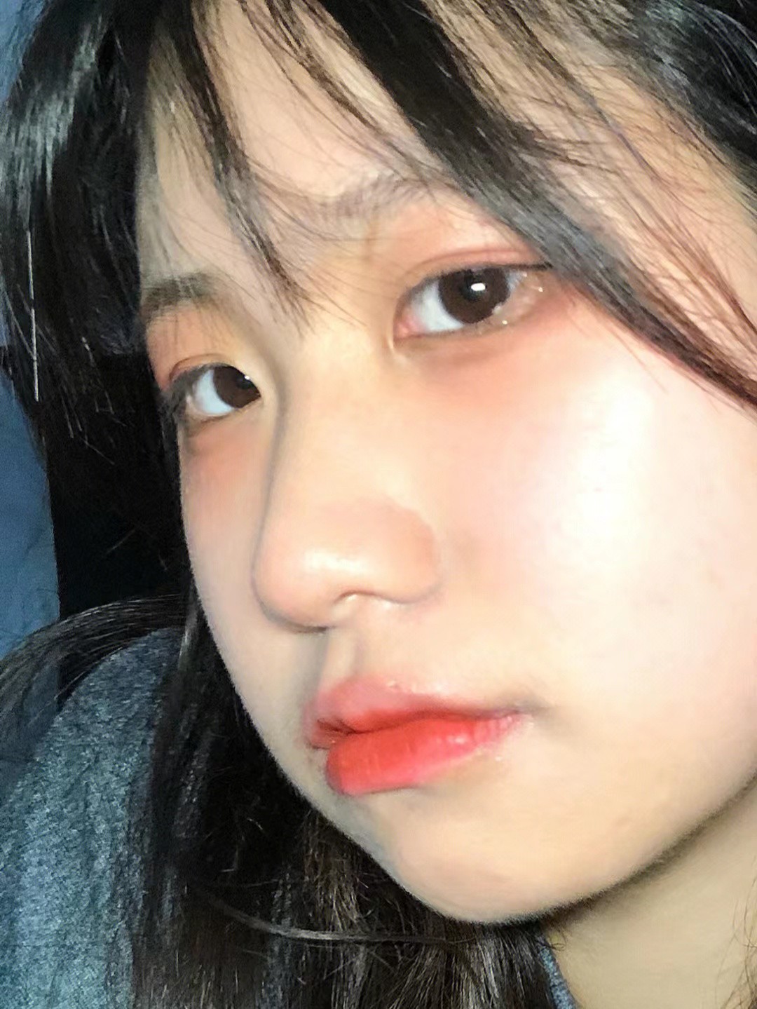 下巴长痘痘是什么原因女生怎么治,下巴长痘痘的原因和解决方法